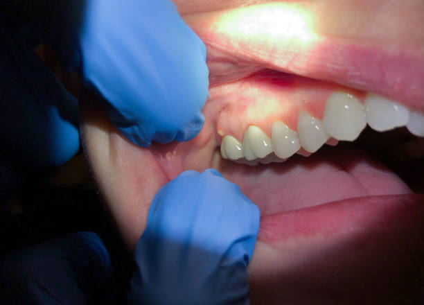 Best Urgent Tooth Repair  in Vega, TX