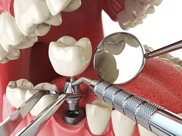 Best Tooth Pain Emergency Relief  in Vega, TX
